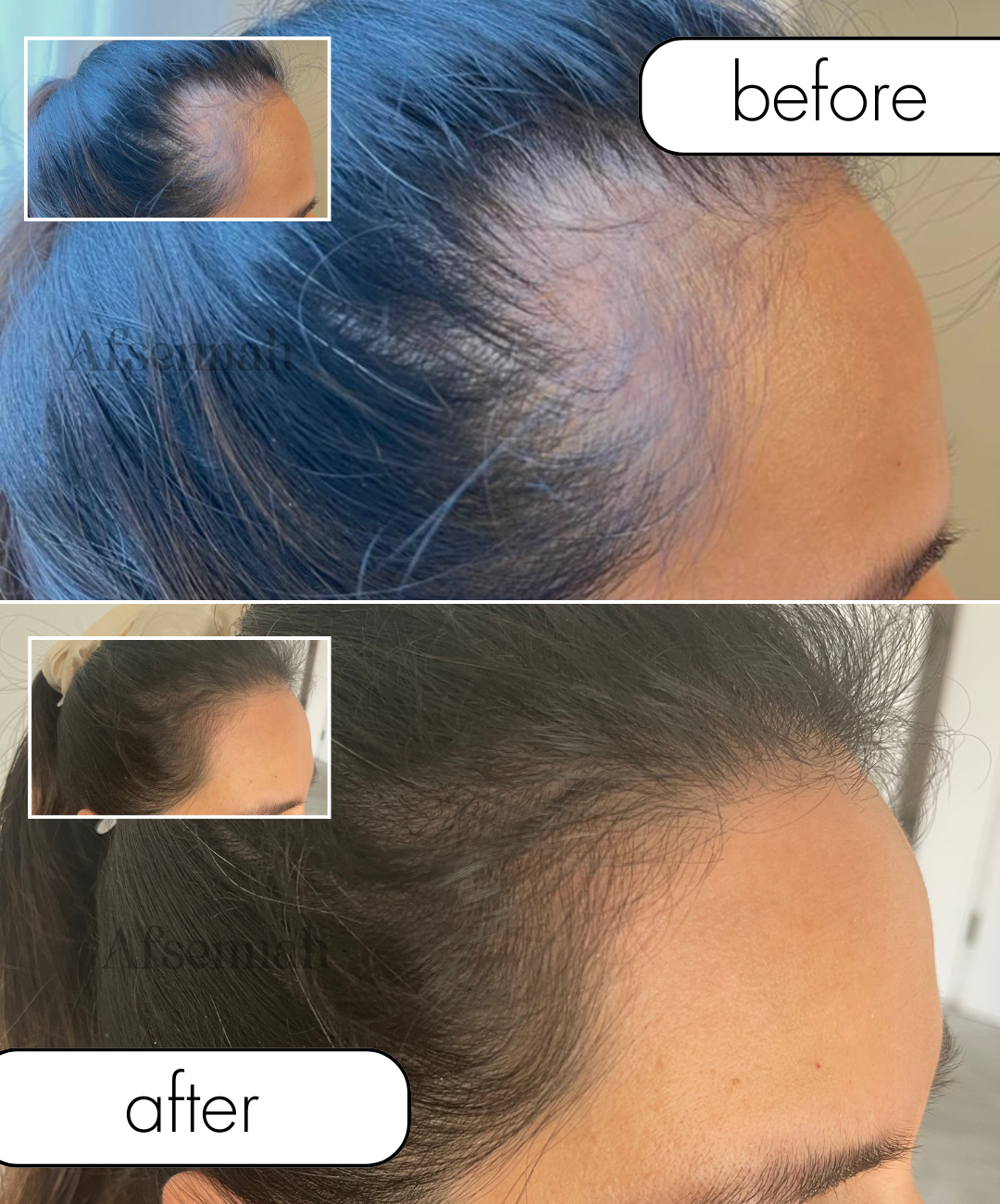 Custom Hair Growth Oil